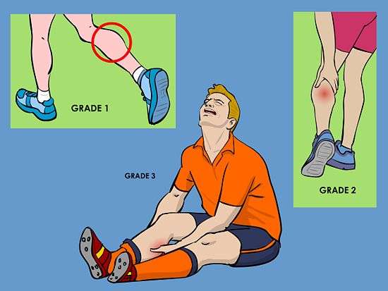 Calf Strain Symptoms Muscle Pull Muscle Pull calf-strain-symptoms-muscle-pull-muscle-pull