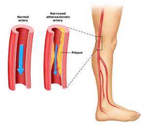 maladies that induce calf muscle pain muscle pull muscle pull