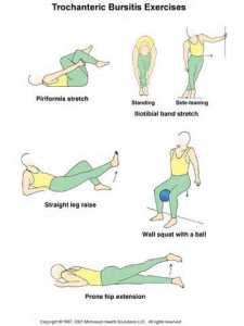 HIP BURSITIS TREATMENT 6 - Muscle Pull | Muscle Pull