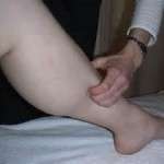 A BASIC MEDICAL CHECKUP FOR SHIN SPLINTS